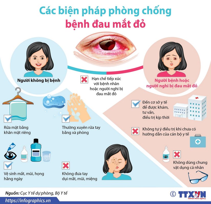 Khuyến cáo phòng, chống bệnh đau mắt đỏ và cách phòng bệnh đau mắt đỏ